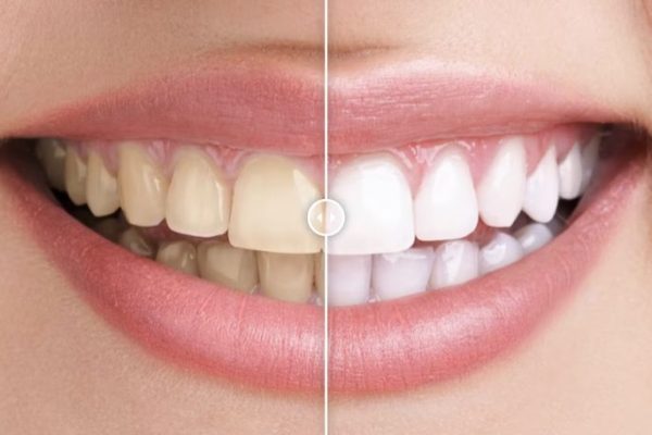 Image Comparison Tool